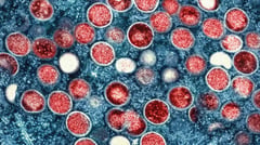WHO warns of more mpox cases in Europe following Sweden’s first case